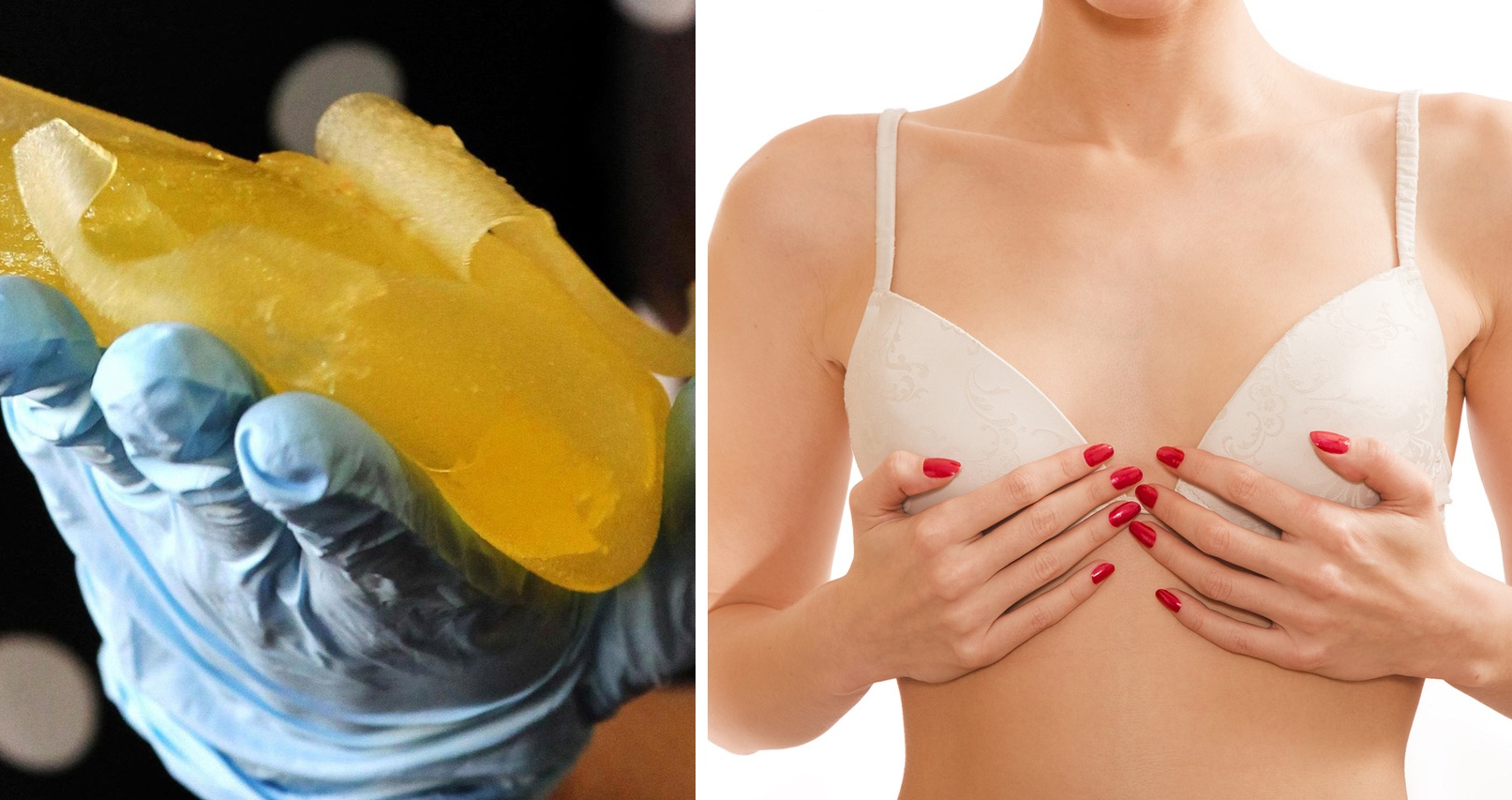 Breast Implants Phuket: The Ultimate Review